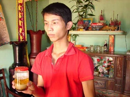 23 người phát bệnh lạ sau khi ăn trăn 'khủng' ảnh 1