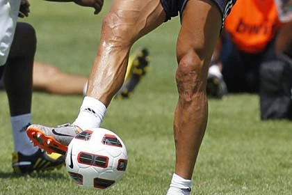 Cận cảnh đôi chân biến dạng của Cristiano Ronaldo ảnh 1