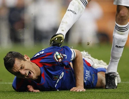 Hành động phi thể thao của Pepe