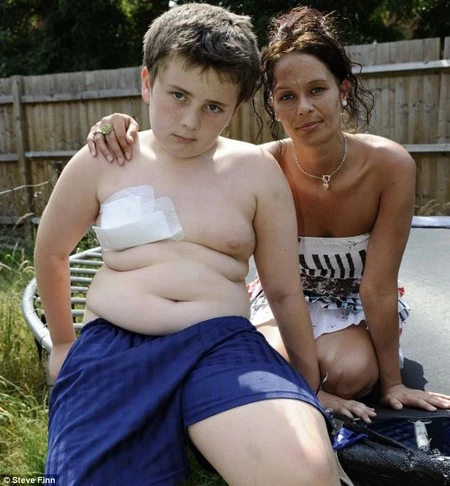 Thoát chết thần kỳ khi bị cọc sắt đâm gần tim ảnh 3 Thoát chết thần kỳ khi bị cọc sắt đâm gần tim ảnh 3