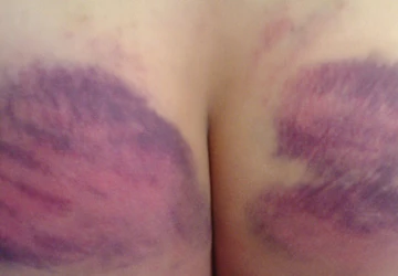 Sở GD vào cuộc vụ giáo viên đánh dập mông học sinh ảnh 1