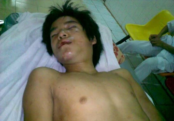 Sáu người dùng tuýp sắt, súng, gí điện hành hạ 1 cậu bé ảnh 1