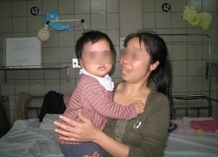 Hạt hướng dương suýt hại chết bé 16 tháng tuổi ảnh 1