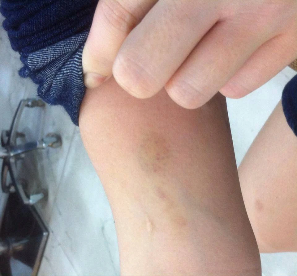 Hành khách “tố” phụ xe buýt hành hung, đuổi khách xuống giữa đường ảnh 2 Hành khách “tố” phụ xe buýt hành hung, đuổi khách xuống giữa đường ảnh 2