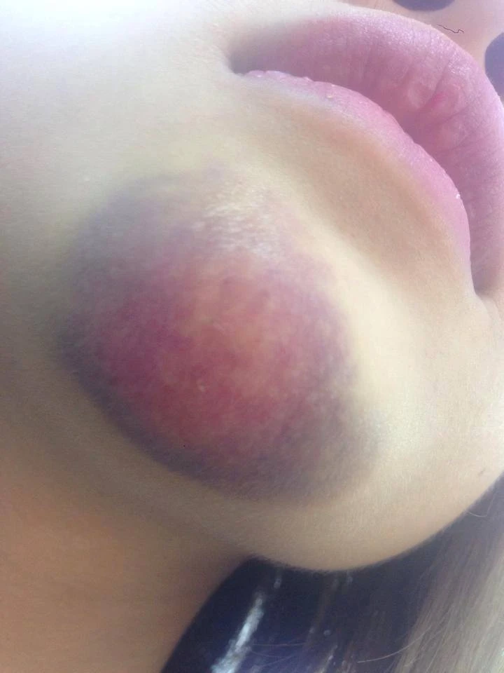 Hành khách “tố” phụ xe buýt hành hung, đuổi khách xuống giữa đường ảnh 1 Hành khách “tố” phụ xe buýt hành hung, đuổi khách xuống giữa đường ảnh 1