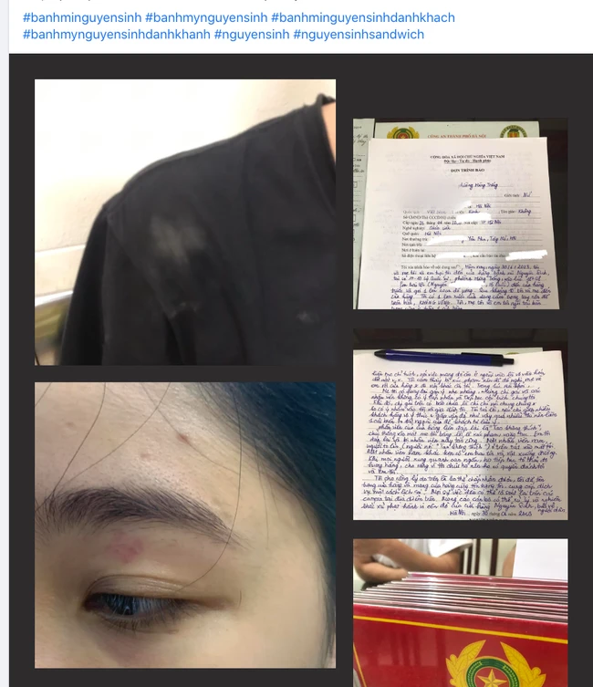 Vị thực khách sau khi xảy ra xô xát với nhân viên quán bánh mì đã đến Công an phường trình báo. Ảnh chụp màn hình