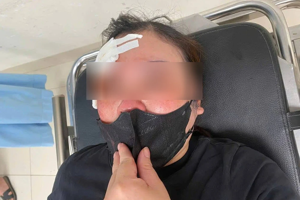 Tài xế xe tải khai lý do đánh người phụ nữ trên phố ở Hà Nội