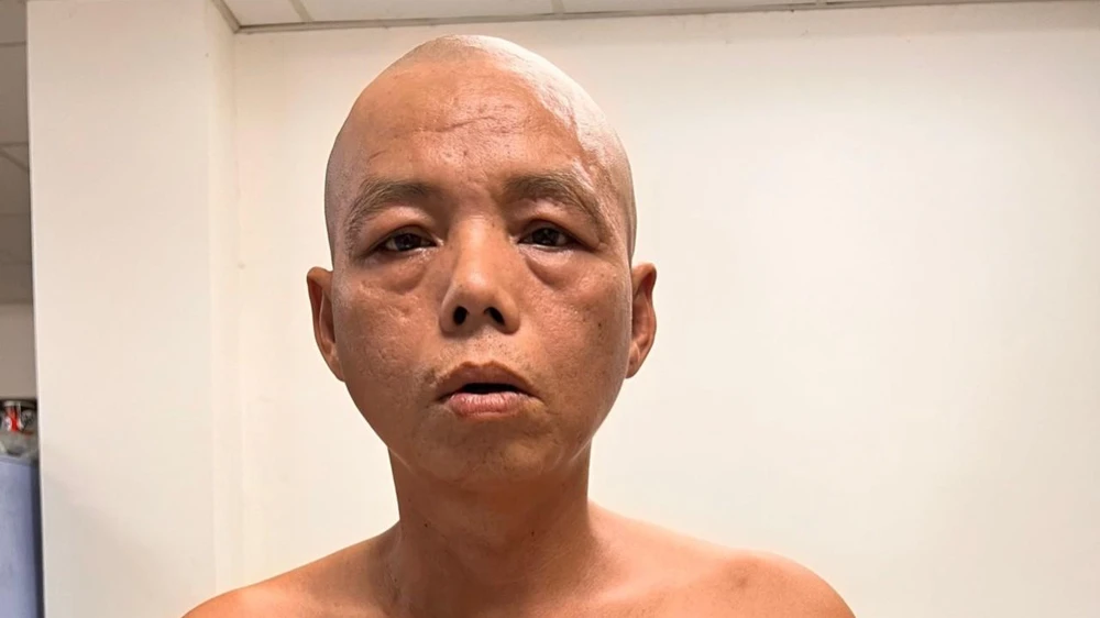 Đại khai nghiện ma túy, trộm các đồng hồ nước rồi bán mỗi cái giá 70 ngàn đồng. Ảnh: CA