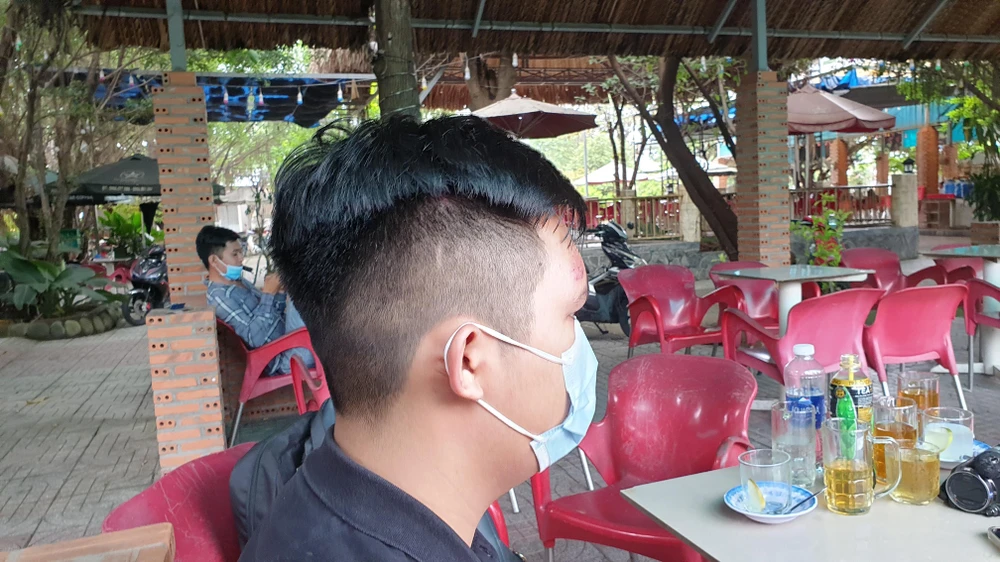 Vụ việc khiến anh K bị xây xát ở mặt, tay. Ảnh: NT