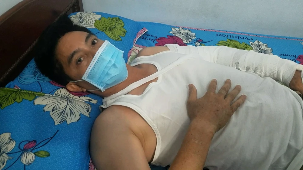 Vụ việc khiến ông A bị thương ở tay và đầu. Ảnh: HT
