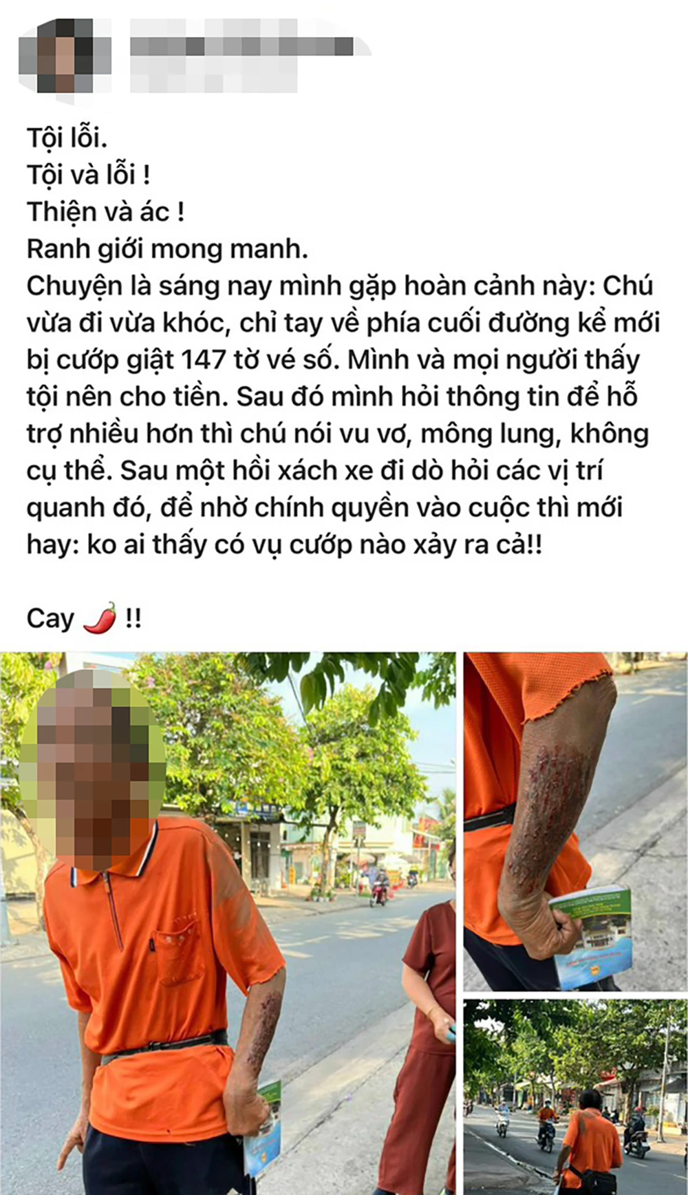 Theo người dân, khi chứng kiến hoàn cảnh của người đàn ông nên đã hỗ trợ. Ảnh chụp màn hình