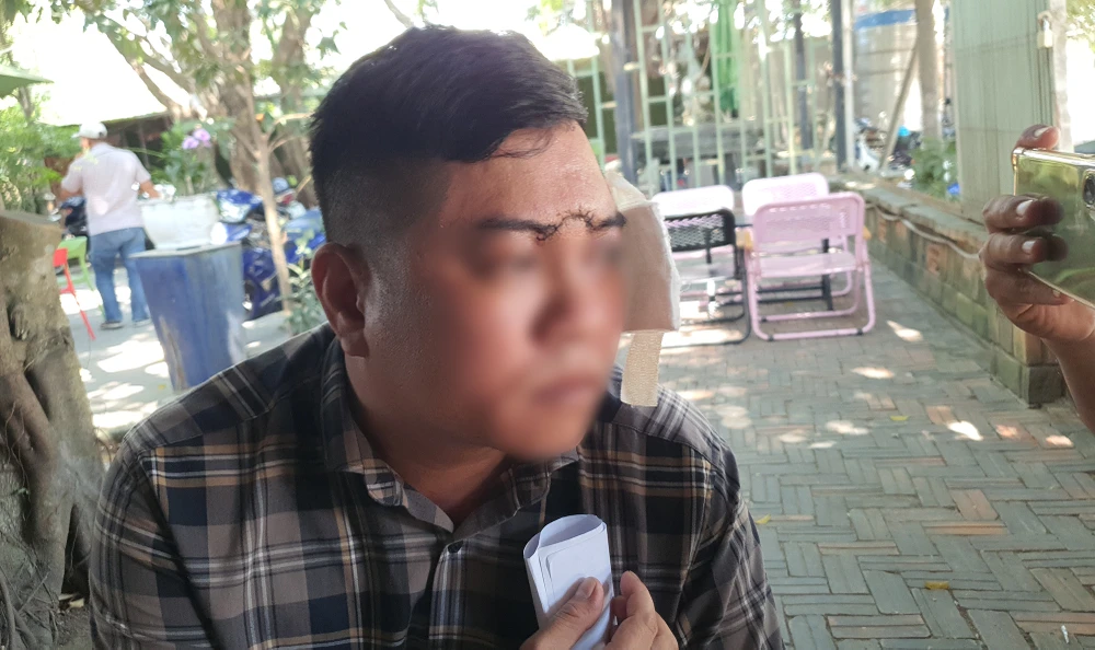 Nhóm người vào quán lẩu bò đập phá, đánh con rể chủ quán vỡ xương sọ