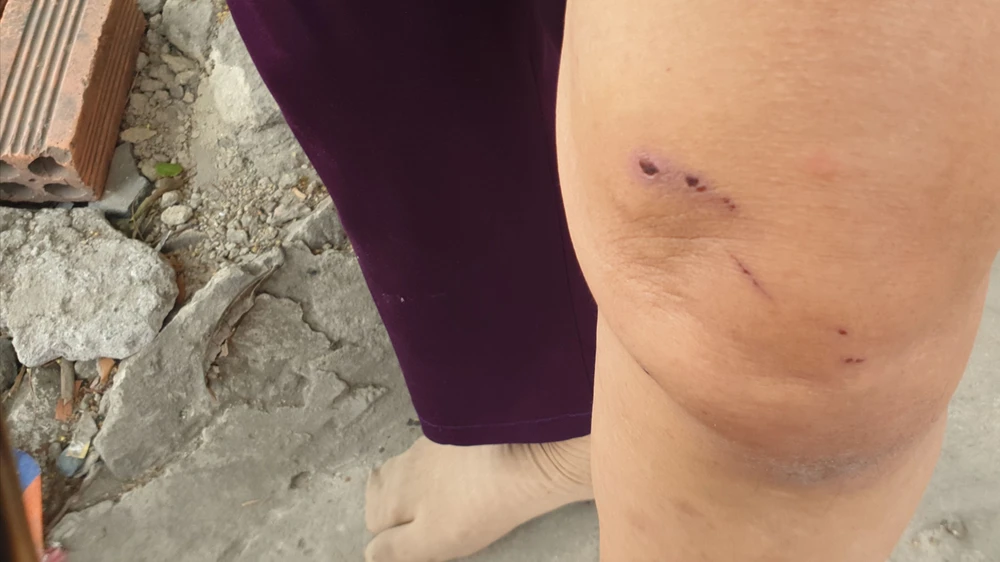 Khỉ đực cổ có đeo xích sắt tấn công 4 người ở quận 12