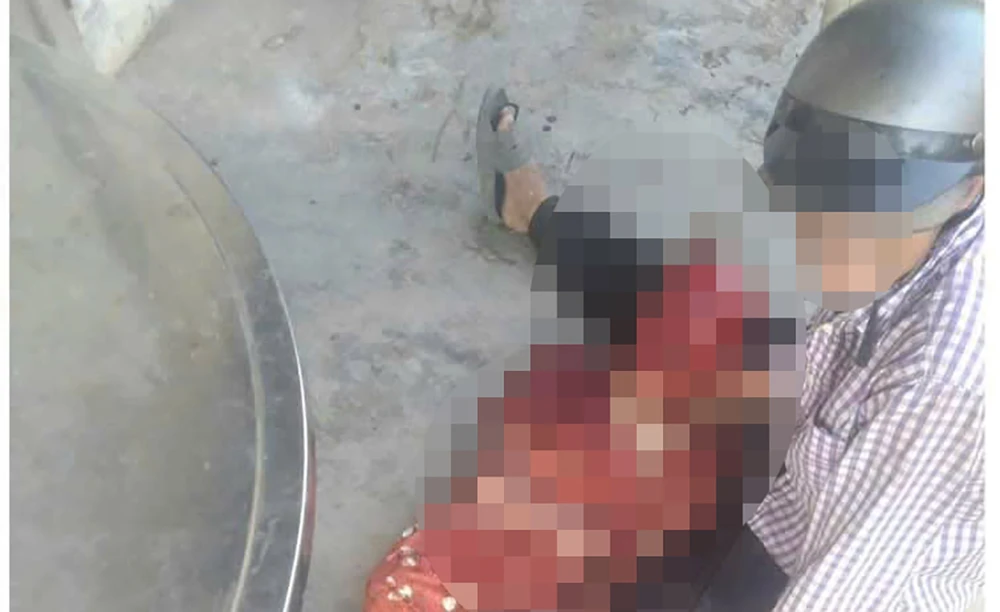 Cụ bà bị con chó cắn tử vong ở Tây Ninh. Ảnh: HT