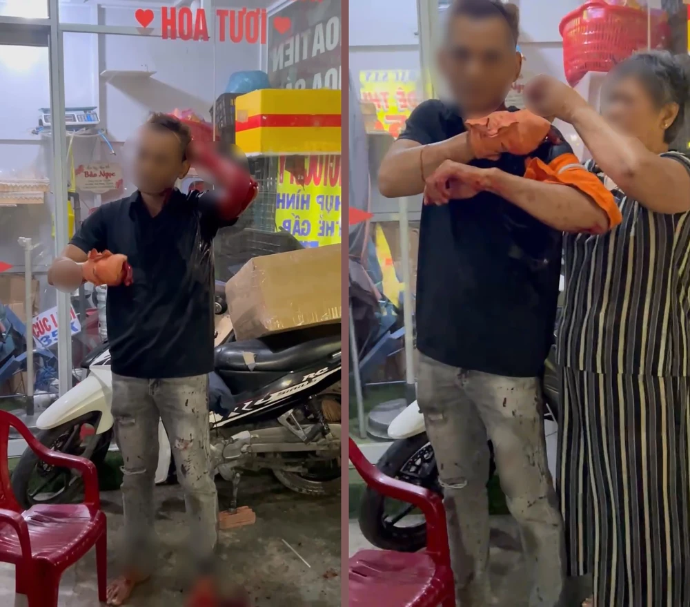 Người giữ xe quán nhậu bị chém nhập viện ở xã Tân Vĩnh Lộc