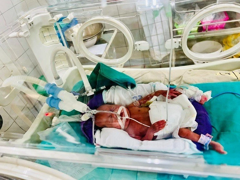 An Chi trong những ngày được nuôi dưỡng trong lồng ấp Bạch Mai. Ảnh: BVCC