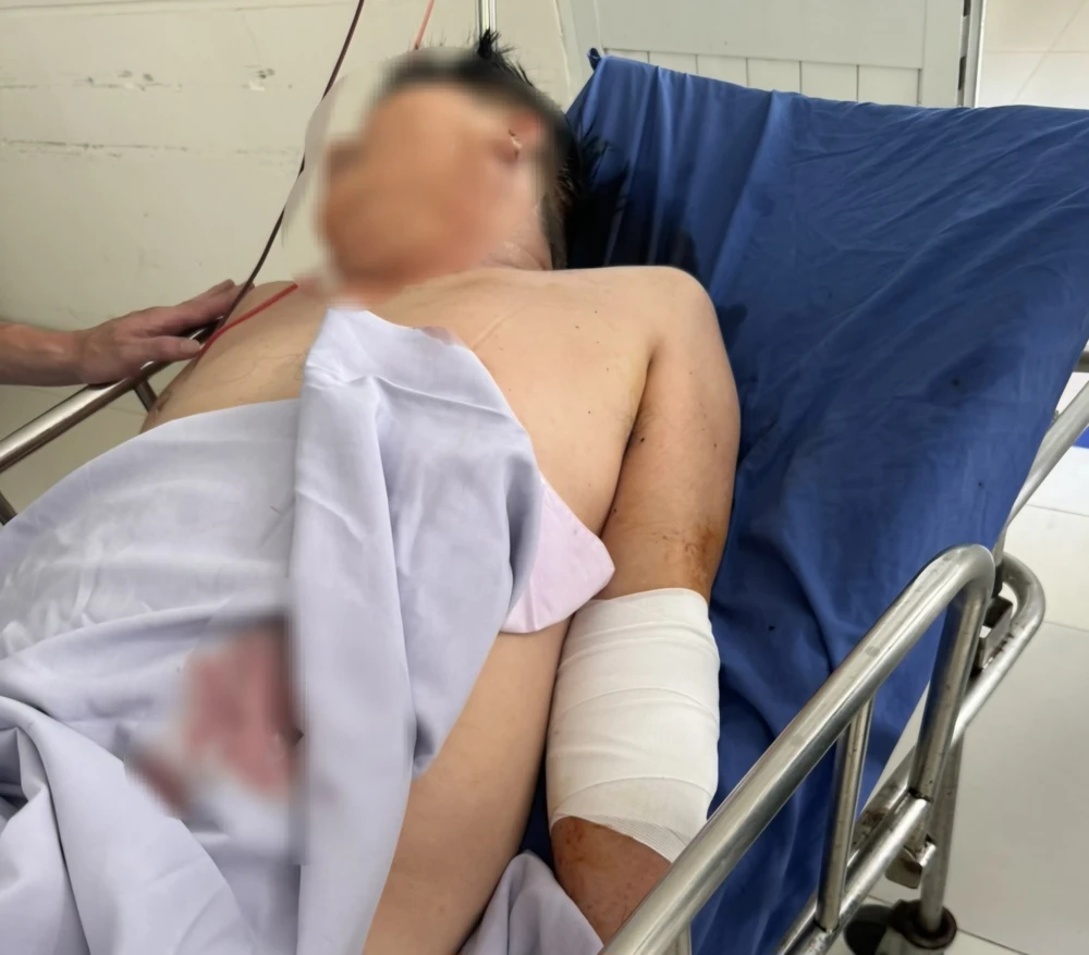 tài xế xe tải bị chém