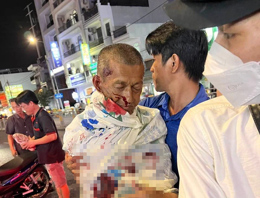 Người đàn ông bị xe máy tông và bị thương, phải đi cấp cứu. Ảnh: NY