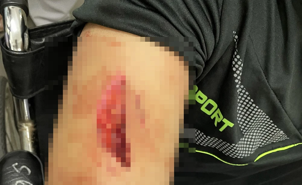 4 người đàn ông đánh trọng thương kỹ thuật viên Bệnh viện đa khoa Long An