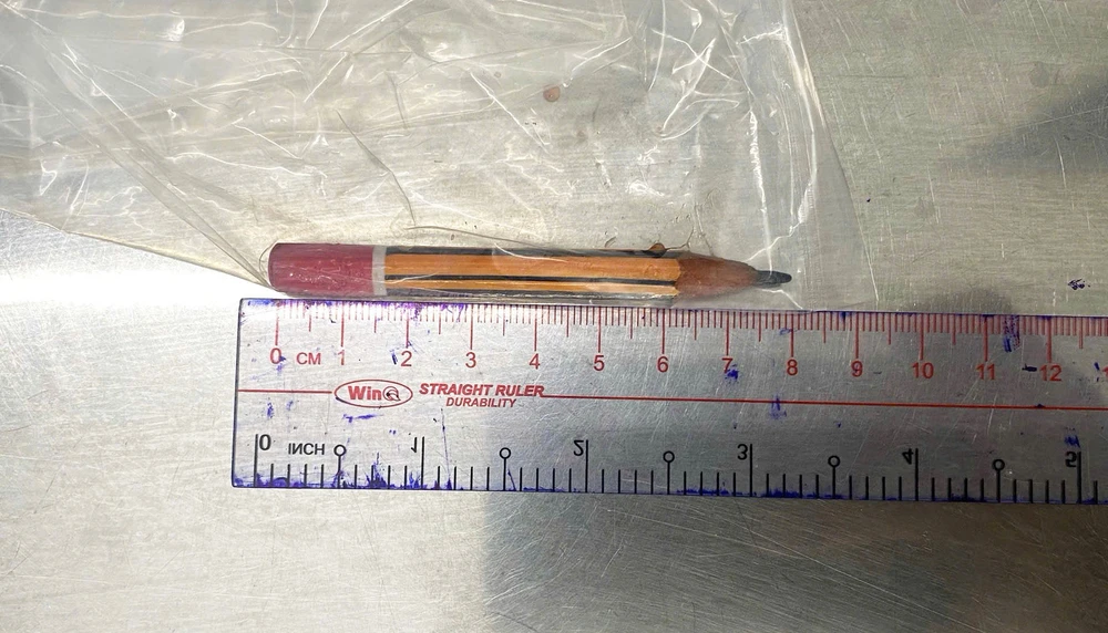 Bé 5 tuổi phải nhập viện vì nhét bút chì vào hậu môn