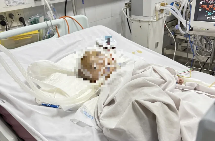 Bé trai 14 tháng tuổi bị bảo mẫu bạo hành ở Quảng Ngãi đã không qua khỏi