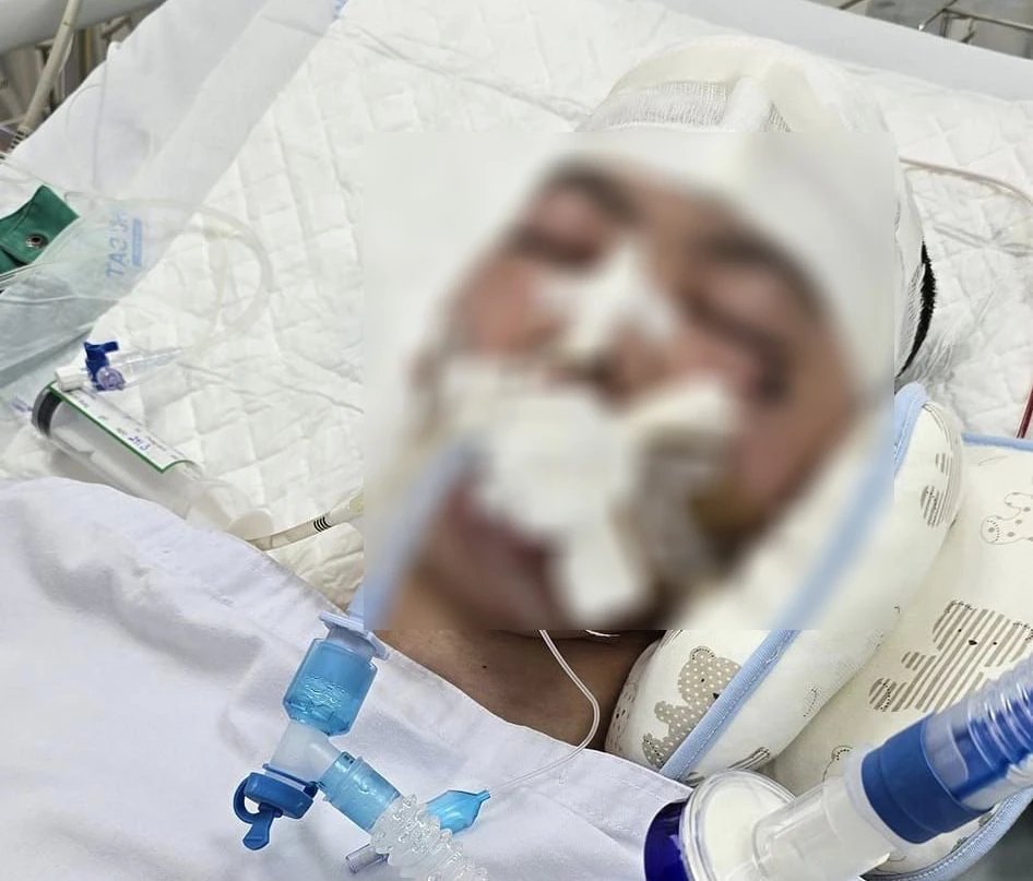 Khởi tố, bắt tạm giam nghi phạm đánh nam sinh lớp 8 chết não