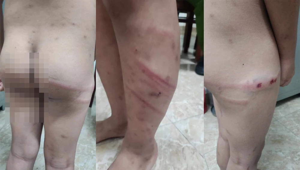 Mẹ ruột và người tình bạo hành con trai 11 tuổi.jpg