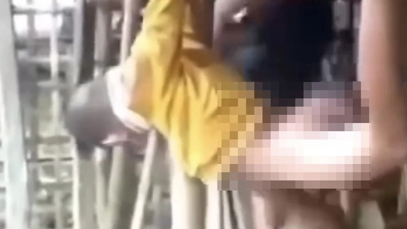 Nghi vấn cha dượng bạo hành con riêng của vợ.jpeg