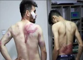 Taliban bị cáo buộc đánh đập các nhà báo Afghanistan