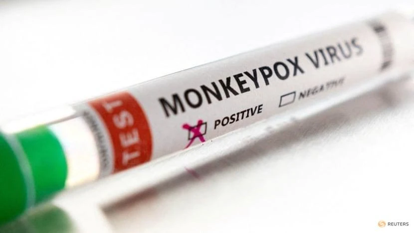 Ống nghiệm có nhãn "Dương tính với virus đậu mùa khỉ" được chụp vào ngày 22-5. Ảnh: REUTERS