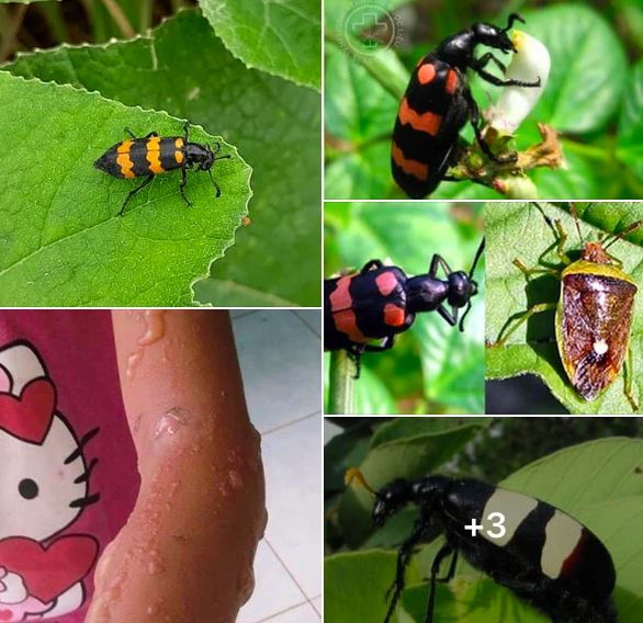 Sâu ban miêu có chất cantharidin cực độc, làm hủy hoại protein, hoại tử ruột, suy đa phủ tạng, hầu hết bệnh nhân tử vong. Ảnh: BV