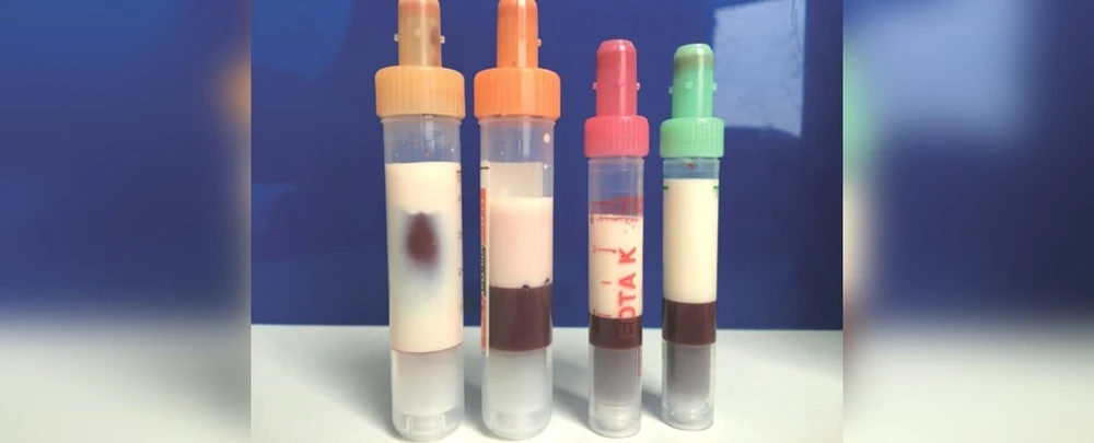 mau-nhiem-mo-bi-chuyen-mau-sua