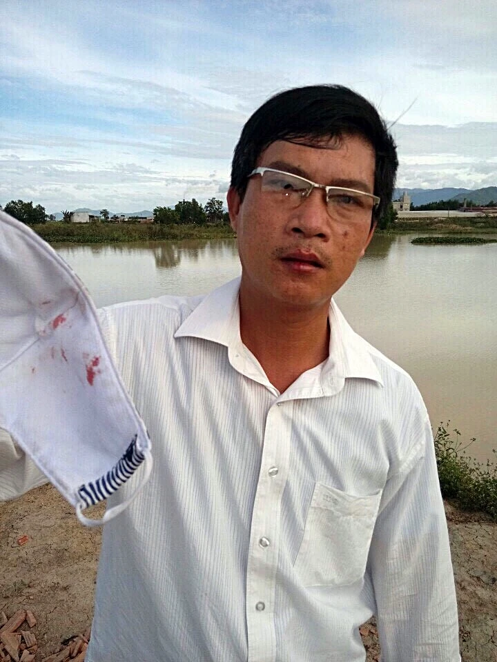 Bắt giam giám đốc tấn công phó chủ tịch xã ảnh 2