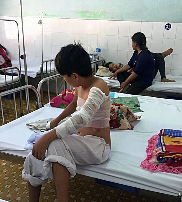 Cha phóng hỏa, 2 mẹ con nhập viện vì bỏng ảnh 1