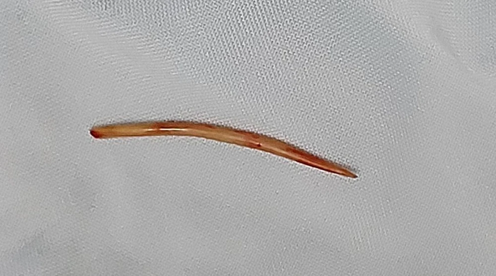 Đoạn tăm được đưa ra ngoài