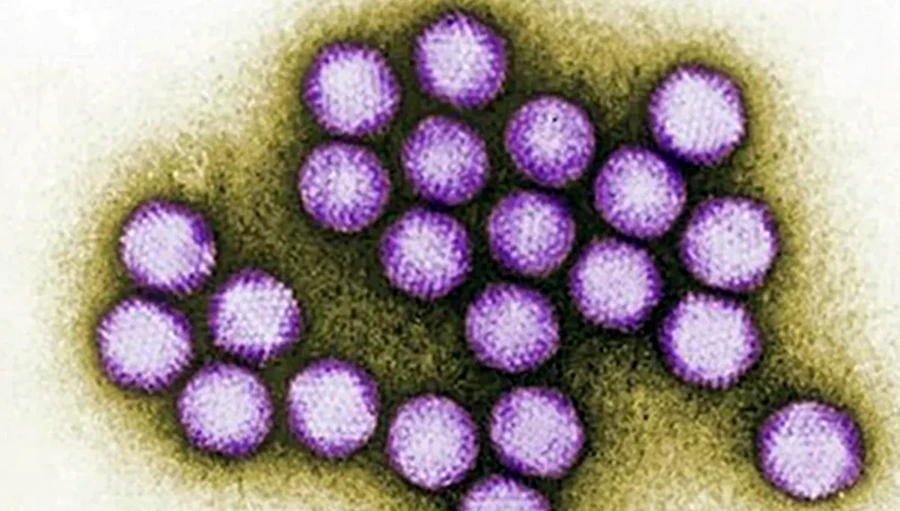 Virus Adeno rất dễ lây lan và có thể gây nhiều biến chứng. Ảnh CDC.