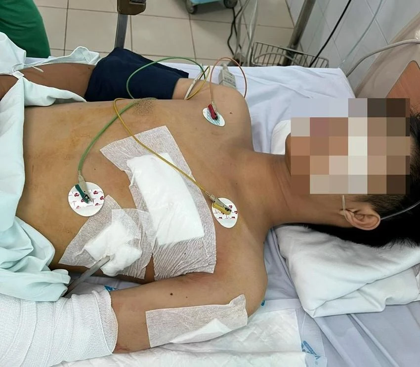 Nạn nhân may mắn được cứu sống với nhiều vết thương nghiêm trọng. Ảnh: BS