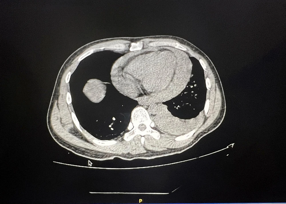 Bệnh viện đã kích hoạt báo động đỏ cứu sống bệnh nhân đang nguy kịch. Ảnh: BVCC