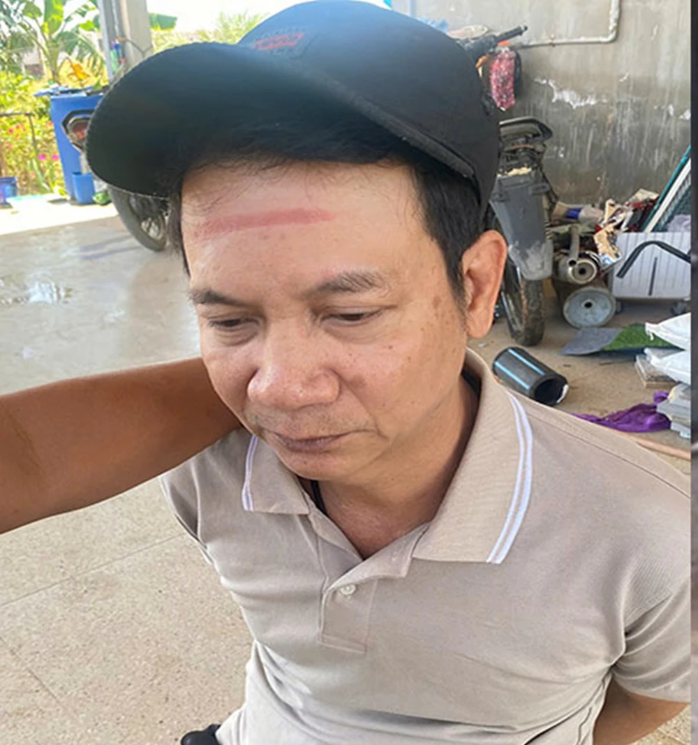 đường dây mua bán