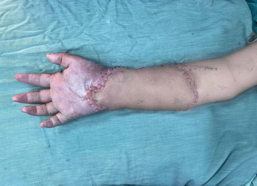 BS-Vo-thai-trung (6).jpg