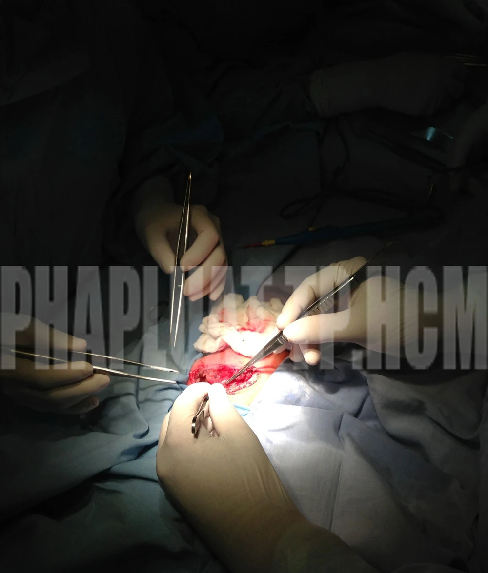 Tách thành công hai bé dính nhau ảnh 3