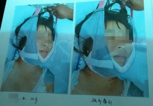 Ling Ling, cô gái xấu số.