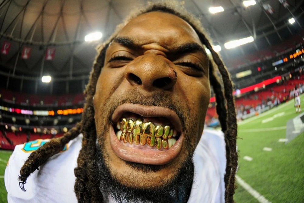 Những hình ảnh hài hước, khó quên nhất làng thể thao năm 2014 ảnh 7