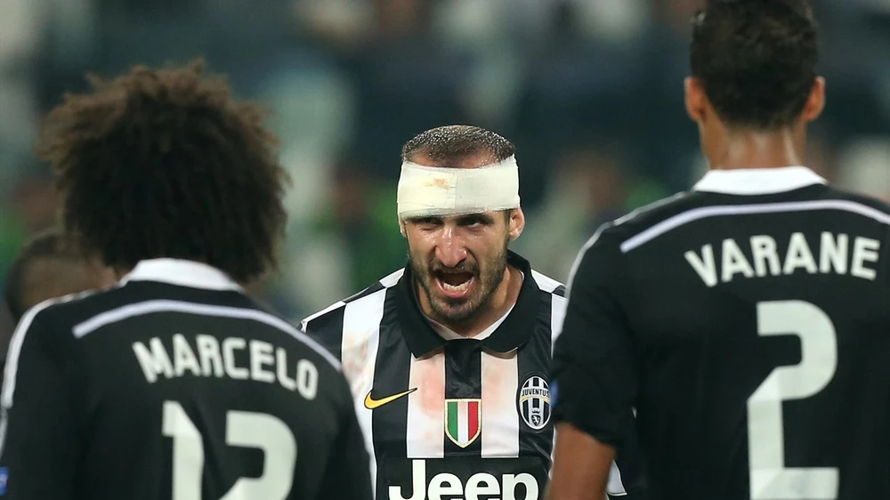 Chiellini