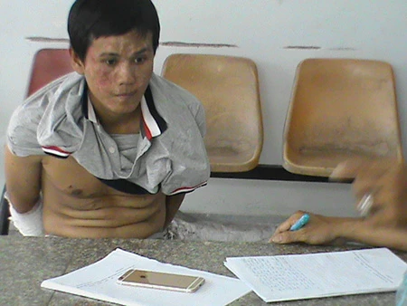  Truy bắt nghi can nhiễm HIV đi cướp, một CSGT bị thương ảnh 1