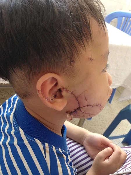 Nhiều trẻ nhập viện vì chó cắn ảnh 2