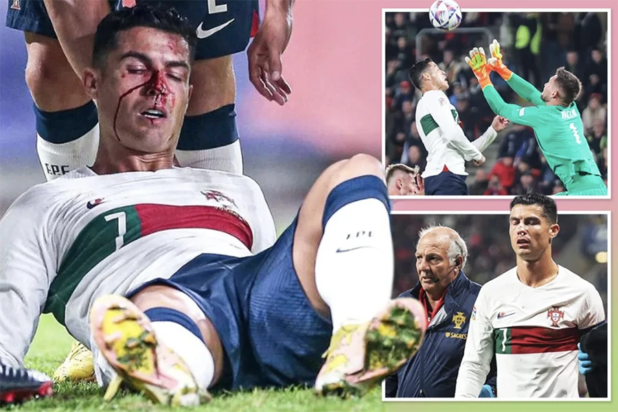 Pha va chạm kinh hoàng khiến Ronaldo bê bết máu. ẢNH: SUN SPORTS