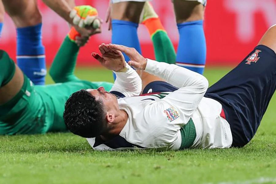 ... và Ronaldo đổ gục xuống sân chảy máu mặt. ẢNH: EPA