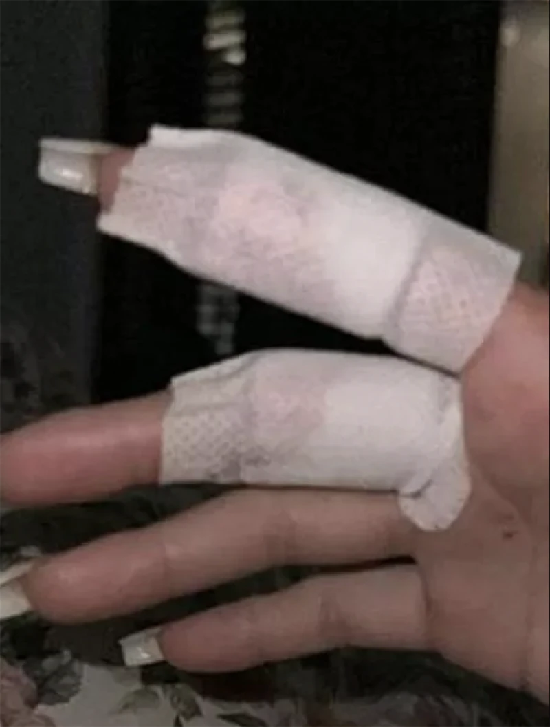 Gabriela Cavallin công bố hình ảnh 2 vết thương trên người cô. ẢNH: INSTAGRAM CAVALLIN