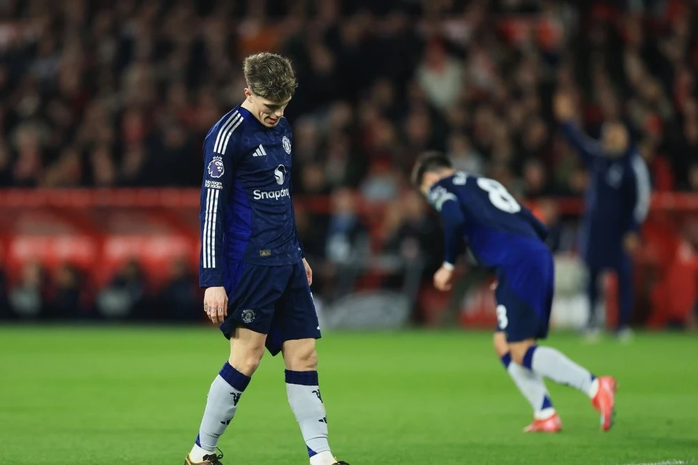 MU từng loại một ngôi sao khỏi trận đấu với Man City,MU,MAN CITY